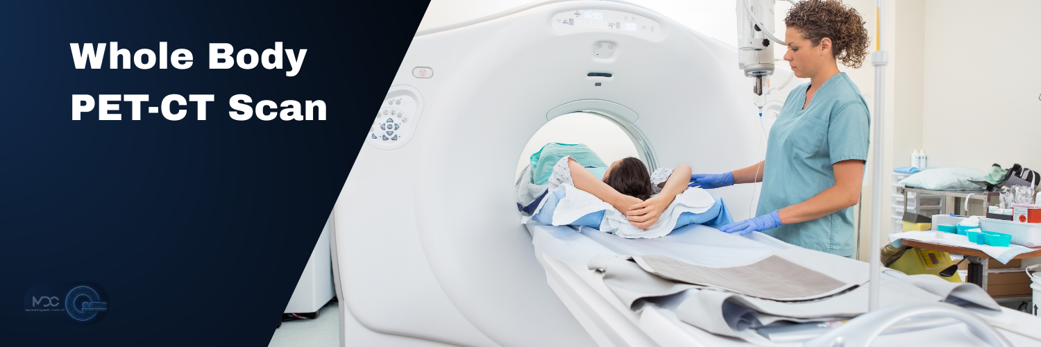 Whole Body PET-CT Scan