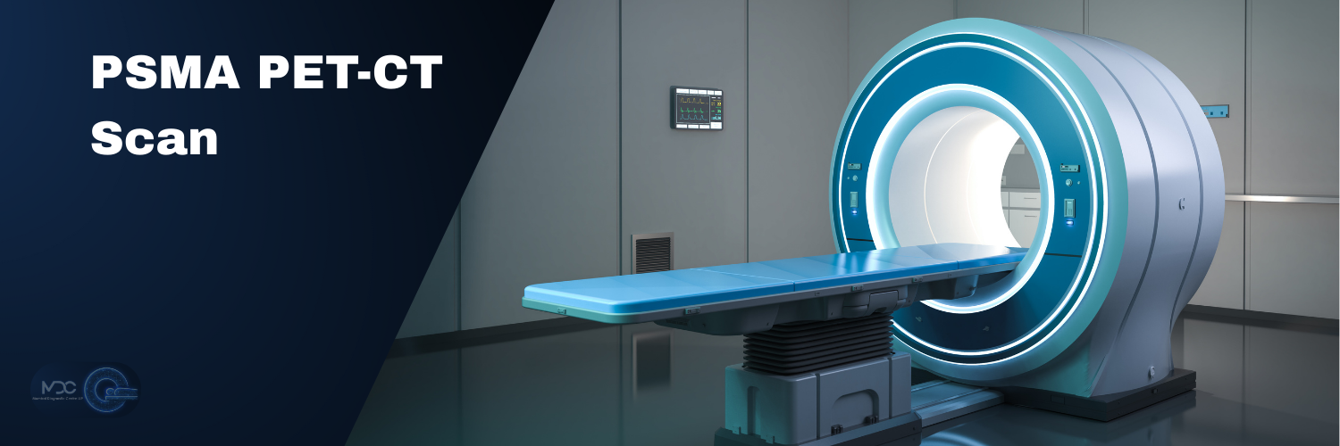 PSMA PET-CT Scan