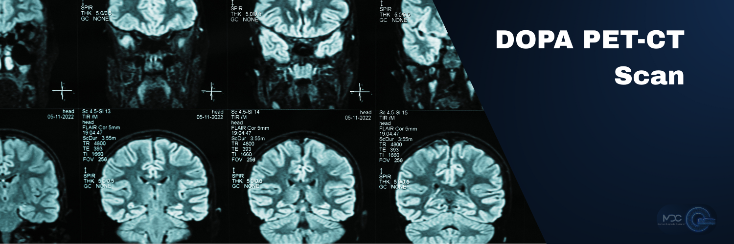 DOPA PET-CT SCAN