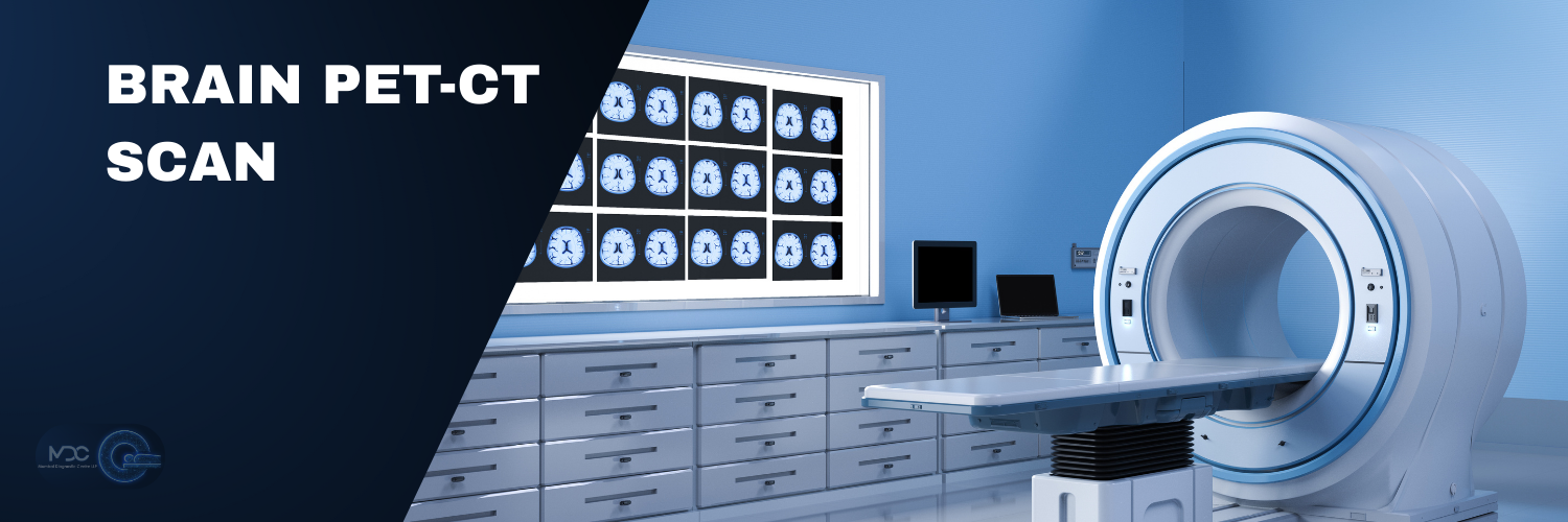 Brain PET-CT SCAN