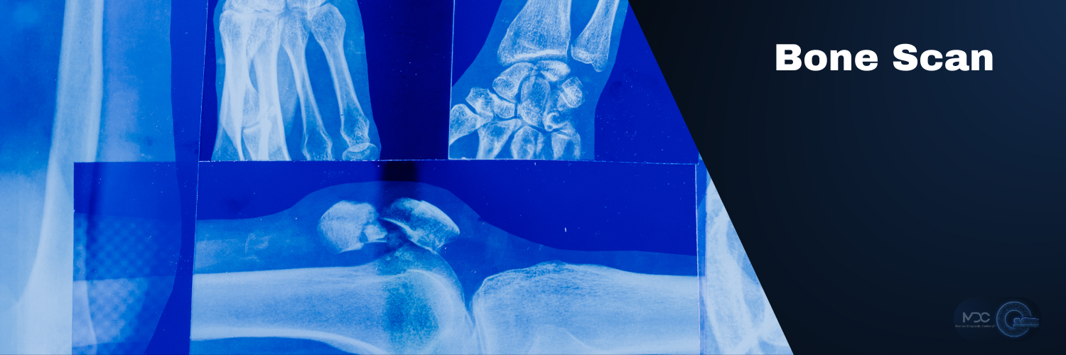Bone Scan