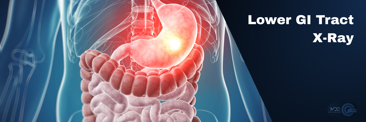 Lower Gi Tract X-Ray
