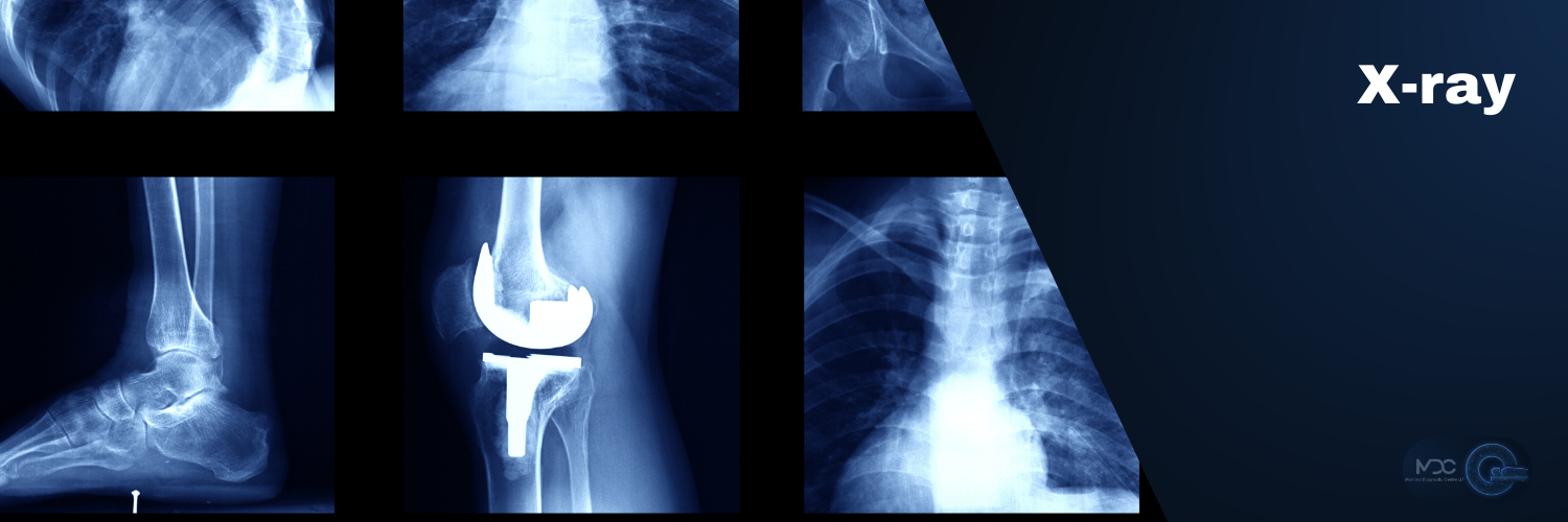 X-Ray
