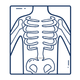 X-Ray