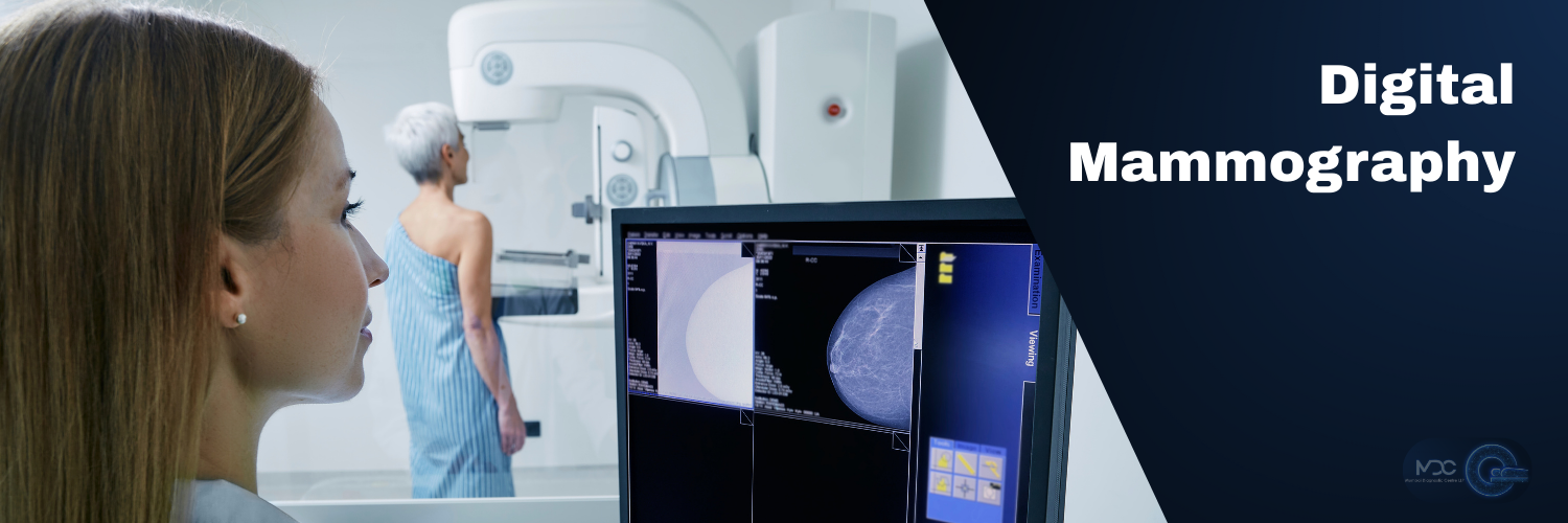Digital Mammography