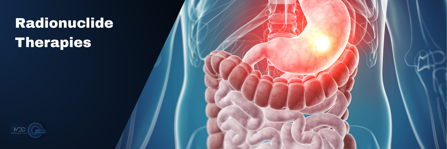 Radionuclide Therapies