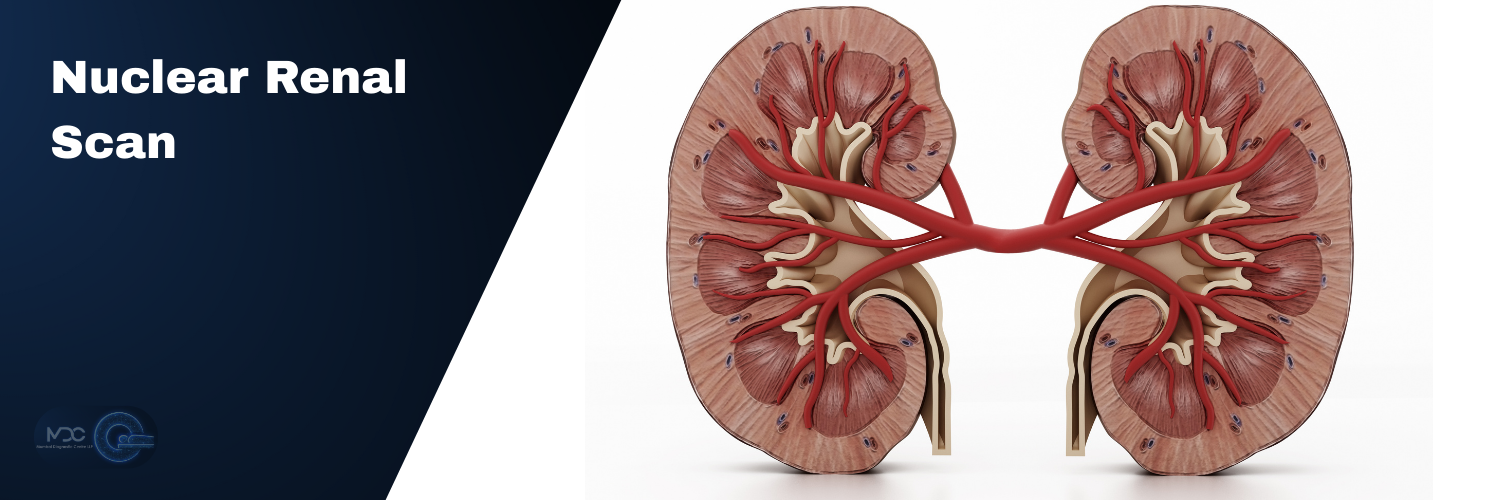 Nuclear Renal Scans